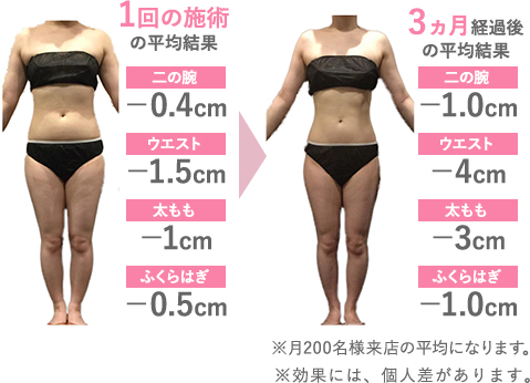 スリムボディセラピスト資格　ビフォーアフター